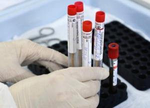 В Украине уже более 201 тыс. случаев COVID-19, за сутки - 2 671