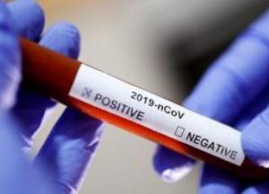 Украина получила тест-систему для выявления нового коронавируса
