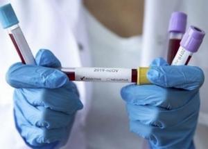В Украине вновь более 15 тысяч новых случаев коронавируса