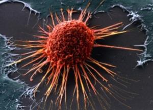 Ученые научились уничтожать раковые клетки голодом