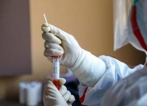 В Украине зафиксировали 480 случаев COVID-19