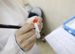 В Украине 2576 новых случаев коронавируса