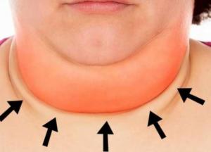 Ученые рассказали о серьезной угрозе двойного подбородка для здоровья человека