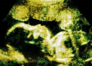 Ученые нашли микропластик в новорожденных младенцах