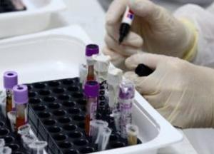 В Украине антирекорд новых случаев COVID-19