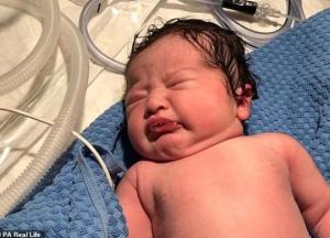 Аномальные волосы новорожденного удивили сеть (фото)