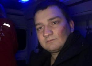 В Сумах напали на нардепа от "Слуги народа"