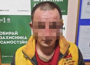 В Николаеве мужчина облил кислотой жену и двоих детей (фото)