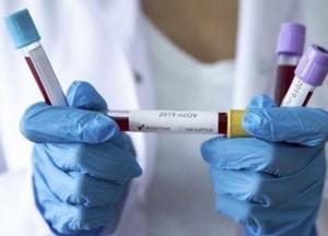 В Украине выросла заболеваемость COVID-19