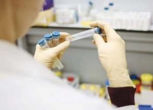 В Украине уже 159,7 тыс. случаев COVID-19, за сутки - 2 905