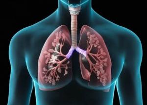 Медики назвали первые симптомы рака легких