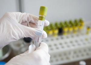 При выходе из карантина украинцев будут проверять на антитела