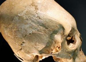 Археологи обнаружили на римском кладбище черепа необычной формы