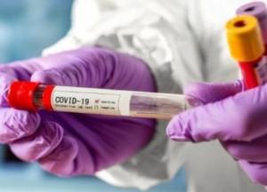 В Украине 265 новых случаев коронавируса