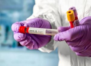 В Украине уже более 27,8 тыс. случаев COVID-19, более 390 - за сутки