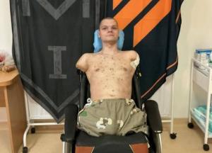 "ПриватБанк" після відмови видати картку ветерану без рук відкуповується: пропонує протезування та лікування