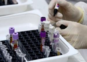 В Украине 16 427 новых COVID-заражений