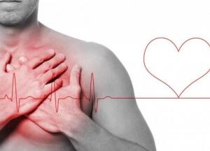 Медики рассказали, кто находится в зоне риска развития аритмии 