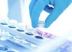 В Украине 876 новых случаев COVID-19