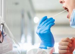 В Украине 6,5 тысяч новых случаев COVID-19