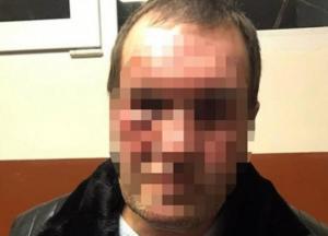 В Киеве мужчине прострелили ногу из-за некачественного ремонта