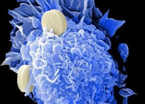 Ученые нашли природное противораковое вещество