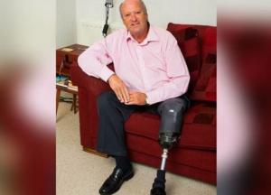 Обычный волдырь привел к ампутации ноги у мужчины