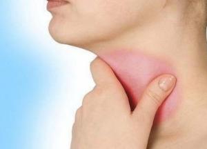 Медики назвали бытовые предметы, нарушающие работу щитовидной железы