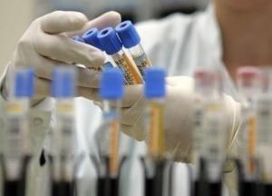 В Украине появятся тест-системы для ускоренного диагностирования коронавируса