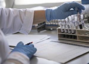 В Киеве подтвердили шесть новых случаев штамма "Дельта" 