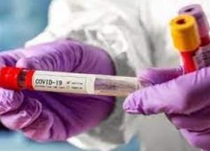 За сутки в Украине 655 новых случаев коронавируса