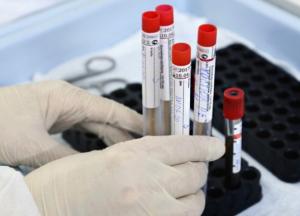 В Украине уже 24 823 случая COVID-19, из них за сутки - 483