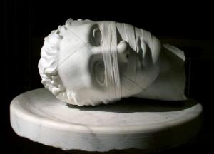 Медики назвали основную причину мигрени