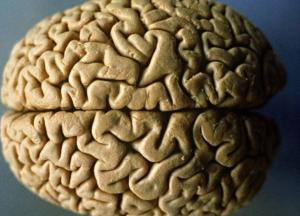 Медики назвали продукты, которые защищают головной мозг от возрастной деградации