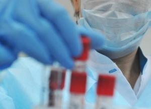 В Украине уже 128 тыс. случаев COVID-19, за сутки - 2 430