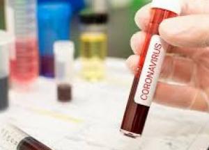 Зеленский пообещал миллион долларов за вакцину или лекарство против коронавируса