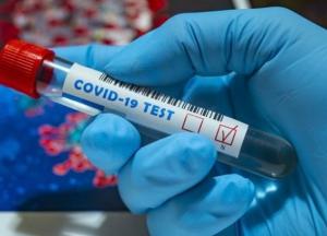 В Украине 12 496 новых случаев коронавируса