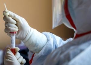 В Украине 7856 новых COVID-заражений