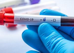 В Украине более семи тысяч случаев COVID за сутки