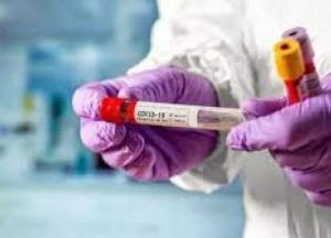 В Украине 10 179 новых случаев коронавируса