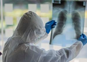 Искусственный интеллект научили "диагностировать" коронавирус по кашлю