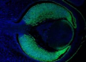 У эмбрионов человека нашли признаки старения