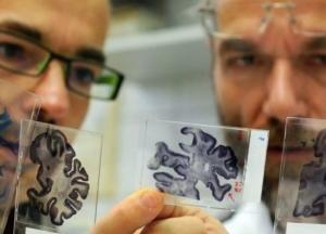 Найдено средство, что остановит старение мозга и улучшит память