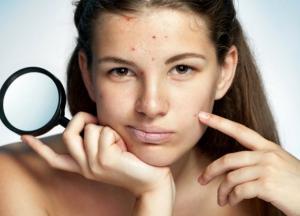 Эндокринологи назвали главные признаки нарушения гормонального баланса