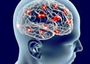 Врачи назвали предупреждающие признаки риска инсульта