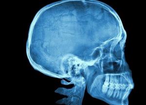 Ученые: форма черепа человека - это результат золотого сечения (схема)