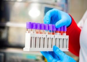 В Украине почти 59,5 тыс. случаев COVID-19, за сутки - 651