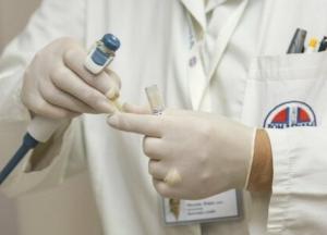 Врачи назвали первые признаки рака кишечника