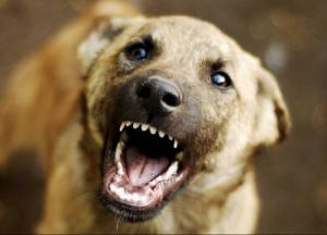 На Київщині сусідський пес напав на 7-річного хлопчика і 8-річну дівчинку, вони у лікарні