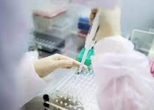 В Украине 213 новых случаев коронавируса